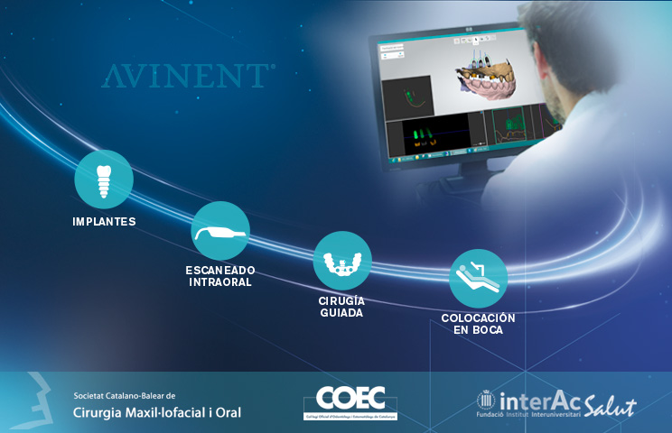 Registration now open for Oral Implantology course organized by Societat Catalano-Balear de Cirugia Maxil·lofacial i Oral in collaboration with AVINENT