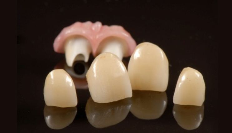 Digital restorative dentistry and pink esthetics