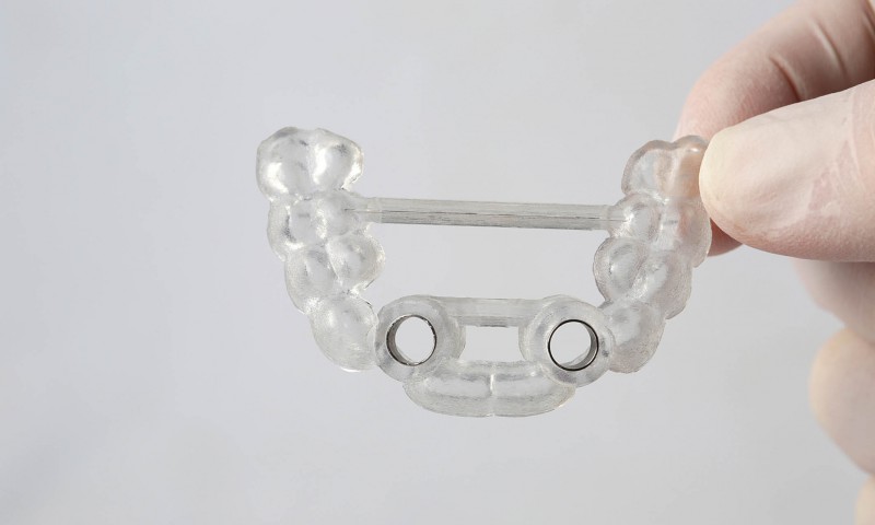 La cirugía guiada: nuevos horizontes para la odontología